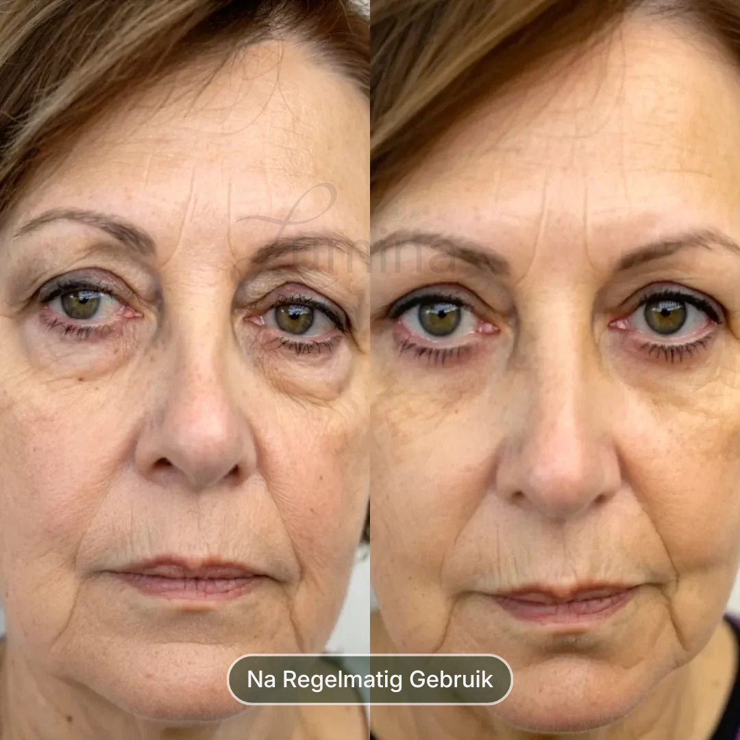 The 10-Minute Eye Reset Protocol™