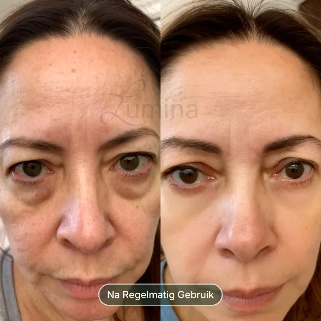 The 10-Minute Eye Reset Protocol™