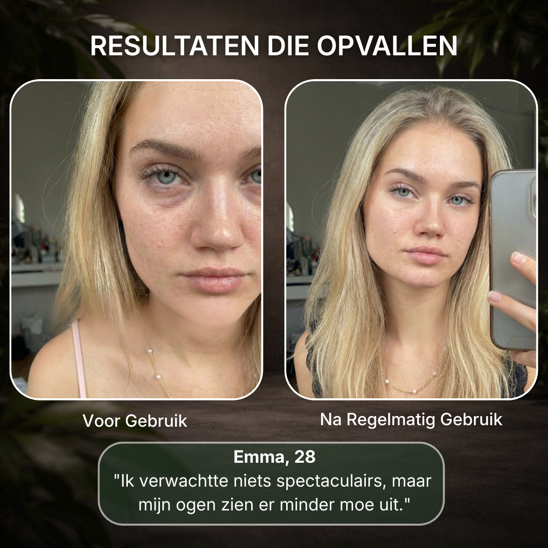 The 10-Minute Eye Reset Protocol™